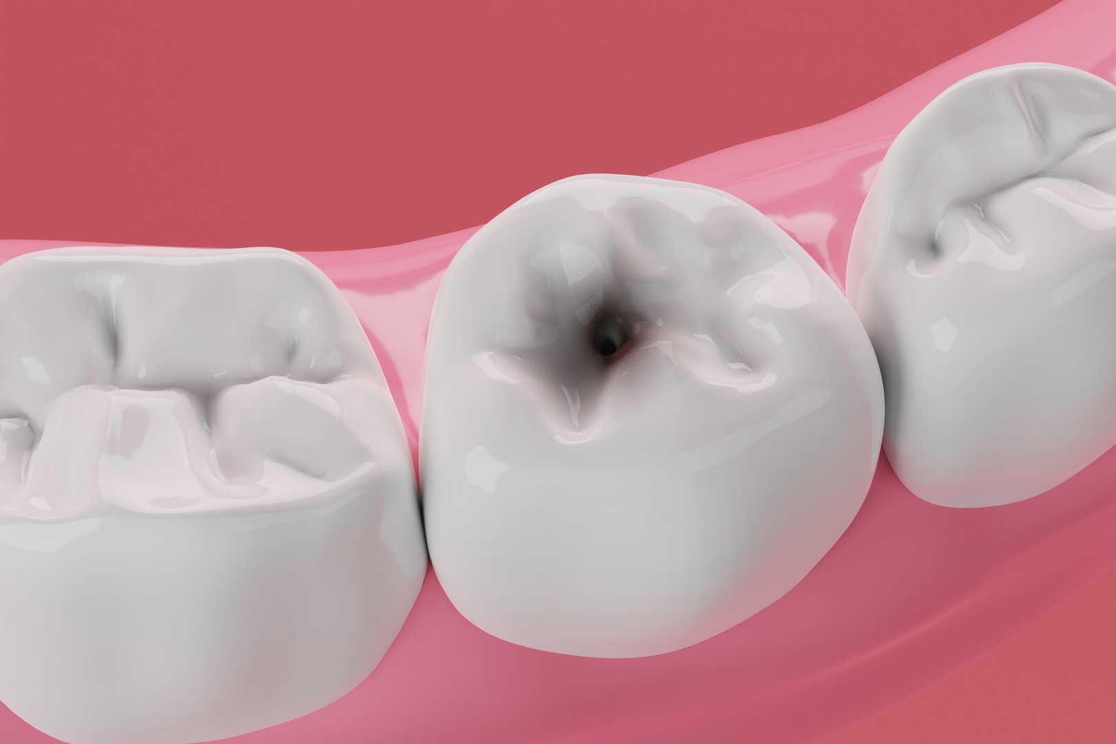 I May Need a Dental Filling, Which Dentist Can Help?