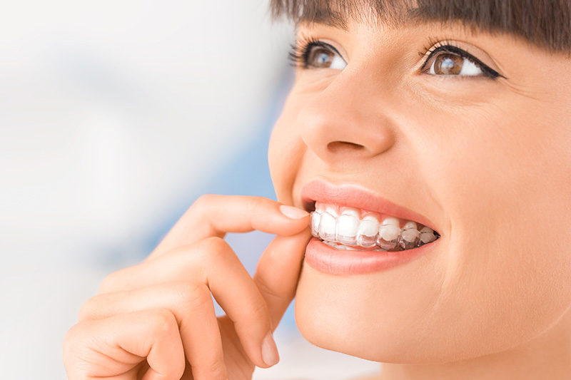 Invisalign in Fort Worth